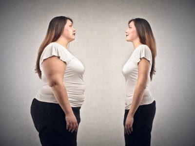 Cosmetic surgery for obese