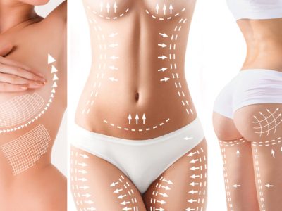 Cosmetic body contouring