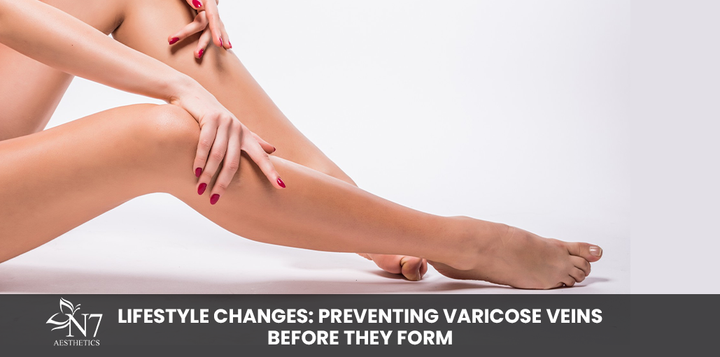Lifestyle Changes: Preventing Varicose Veins Before They Form