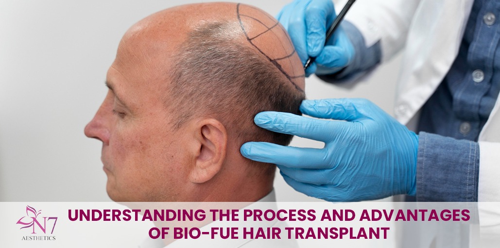 Understanding the Process and Advantages of Bio-FUE Hair Transplant