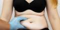 Mini Abdominoplasty - n7aesthetics