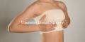 Cosmetic Breast Surgery