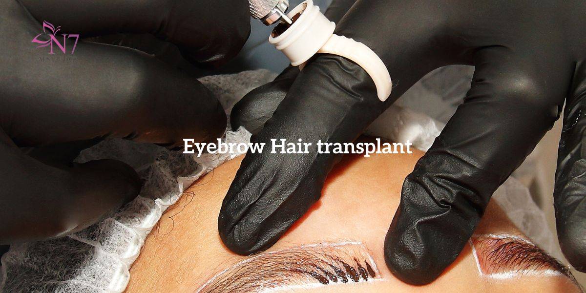 Eyebrow Hair transplant